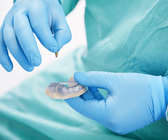 cuanto-dura-el-procedimiento-de-un-implante-dental-previaimplantcenter