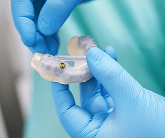 excelentes-implantes-dentales-economicos-en-tijuana-previaimplantcenter