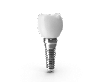 previaimplantcenter-como-es-el-procedimiento-de-un-implante-dental-optimo