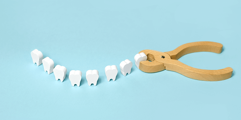 cuantos-implantes-dentales-se-pueden-poner-en-un-dia