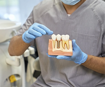 implantes-dentales-rapidos-se-diferencian-de-los-implantes-tradicionales-en-que-el-tiempo-de-colocacion-previa-implant-center-tijuana